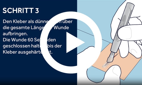 Vorschaubild eines Videos